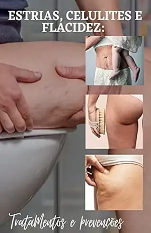 Regenere seu corpo em 30 dias: Tratamentos e prevenções (estrias, celulites, flacidez, varizes e rugas) - Yasmin Munhos