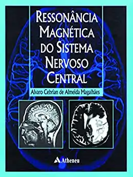 Baixar Ressonância Magnética do Sistema Nervoso Central (eBook) pdf, epub, mobi, eBook