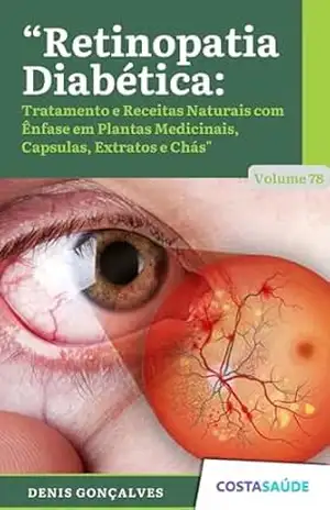 Retinopatia Diabética: Tratamento e Receitas Naturais com Ênfase em Plantas Medicinais, Capsulas, Extratos e Chás – Volume 78 – Denis  Gonçalves