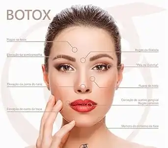 Baixar Técnicas e Marcações Toxina Botulínica (Botox) pdf, epub, mobi, eBook