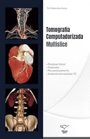 Capa do livro Tomografia Computadorizada Multislice - Alexandre Araújo Santos