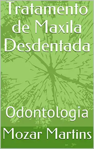 Baixar Tratamento de Maxila Desdentada: Odontologia pdf, epub, mobi, eBook