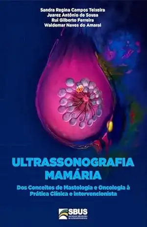 Capa do livro Ultrassonografia Mamária: Dos Conceitos de Mastologia e Oncologia - Juarez Antônio de Sousa