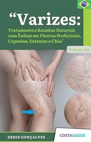 Varizes: Tratamento e Receitas Naturais com Ênfase em Plantas Medicinais, Capsulas, Extratos e Chás – Volume 104 – Denis  Gonçalves